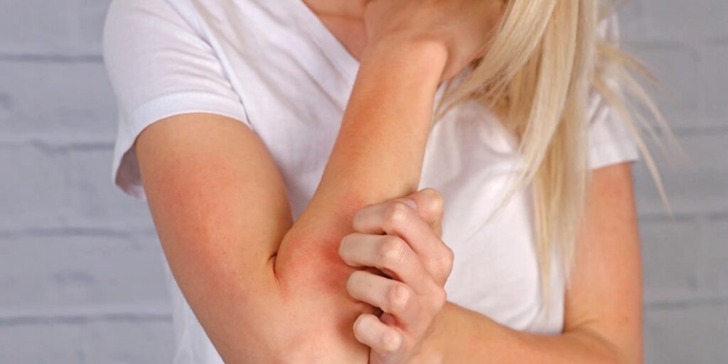 Femme tenant son œil douloureux, illustrant une consultation ophtalmologique pour douleur oculaire.