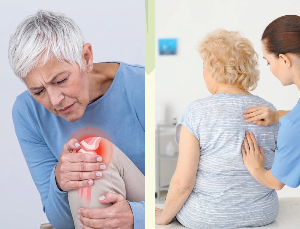 osteoporose
